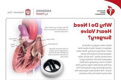 Heart valve surgery Answers by Heart sheet